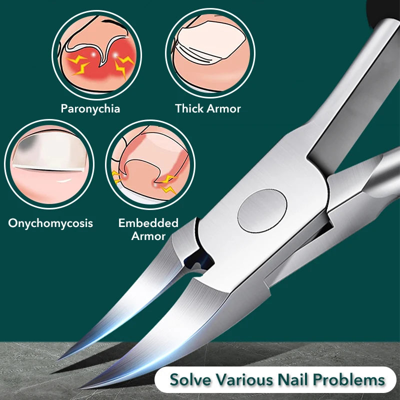 Ingrown Nail Clipper