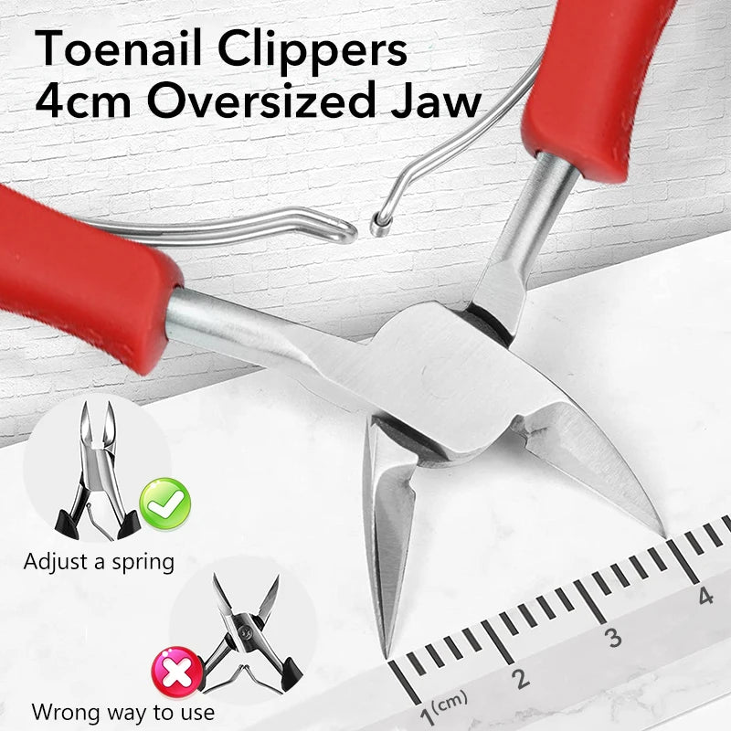 Ingrown Nail Clipper
