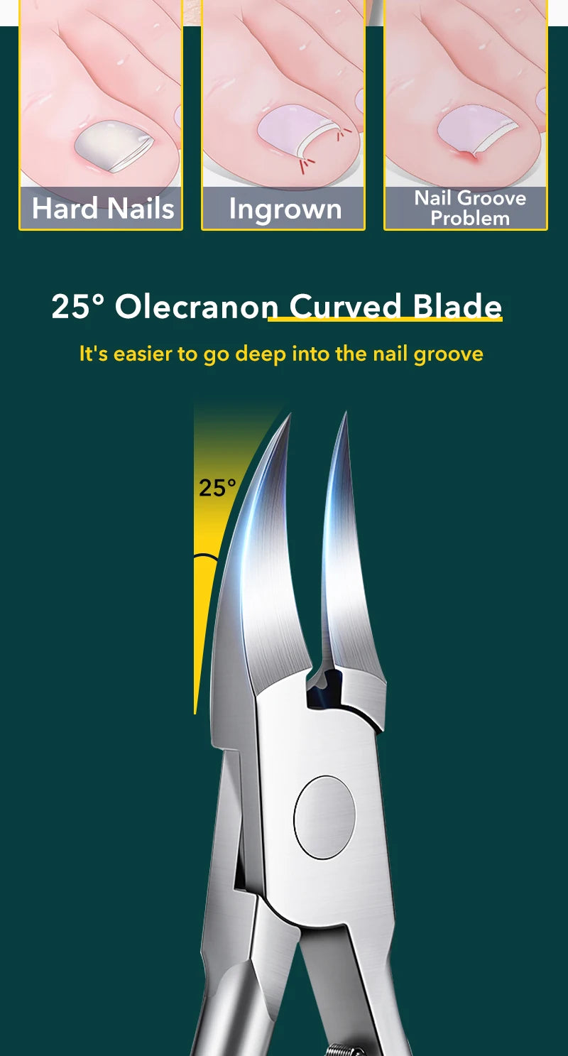 Ingrown Nail Clipper